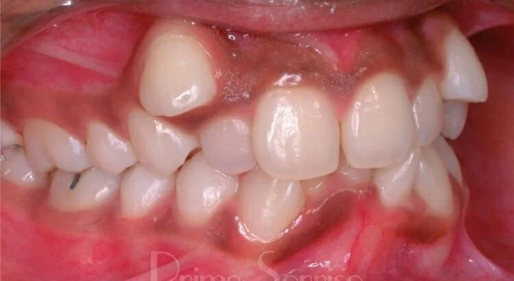 várias bocas em posições diferentes. com dentes, língua, sorriso