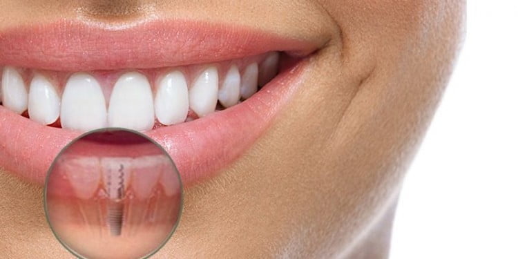 Ortodontia pode resolver DTM? - Dentista em Foz do Iguaçu - Aparelho  Ortodôntico - Facetas - Implantes - Próteses - Prime Sorriso Odontologia