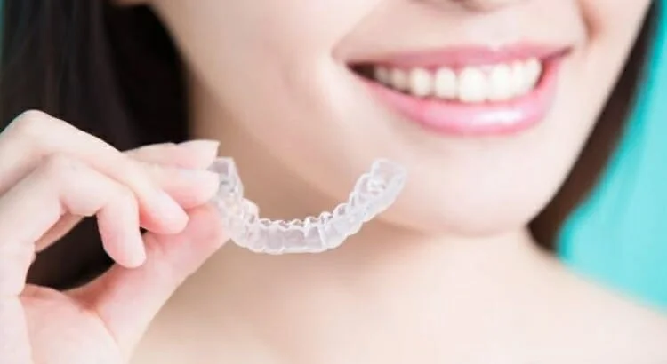 Como funciona o alinhador dental transparente? Alternativa para