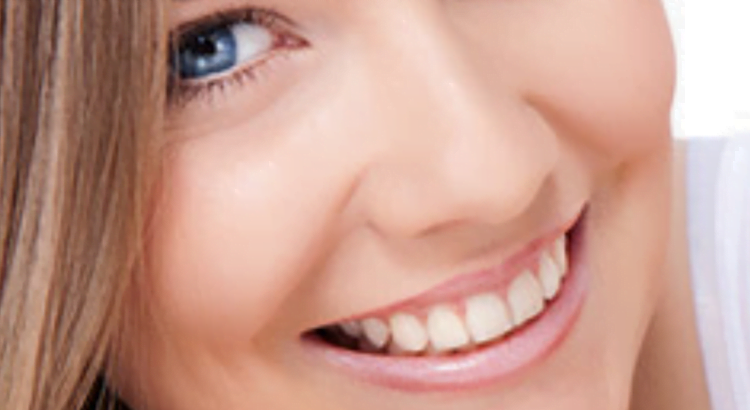 Lentes de contato dentarias