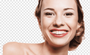 Cuidados pôs aparelho