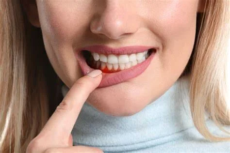 Como evitar a perda dos dentes