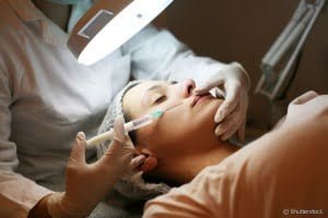 Aplicação de botox na odontologia