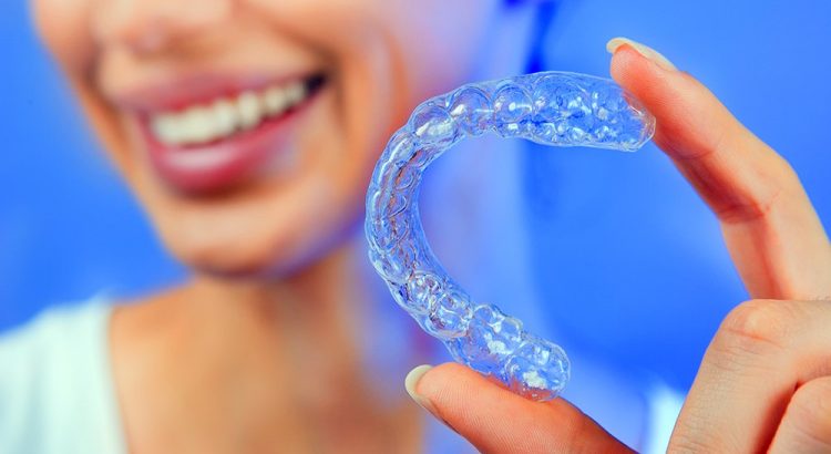 alinhadores invisiveis