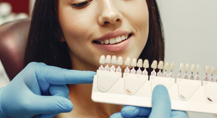 Como é o Processo de Colocação de Facetas Dentárias