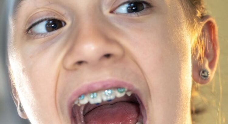 Importância da higiene bucal durante o tratamento ortodôntico