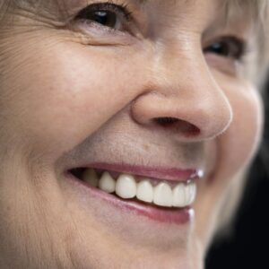 Tratamento ortodôntico na terceira idade melhorando a saúde bucal de idosos