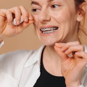 Higiene bucal eficaz durante o uso de aparelhos ortodônticos fixos