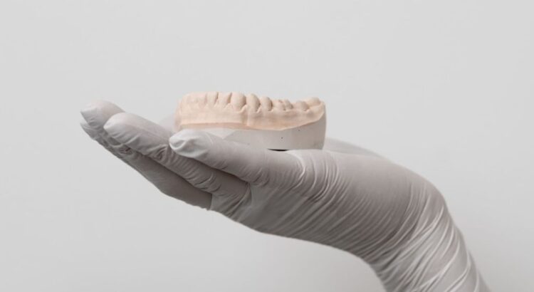 Mini-implantes ortodônticos usados em tratamentos para movimentação dentária precisa