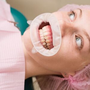Tratamento ortodôntico para pacientes com fissura labiopalatina para melhorar estética e função