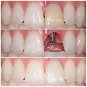 dentista realizando avaliação odontológica completa com tecnologia digital na Prime Sorriso