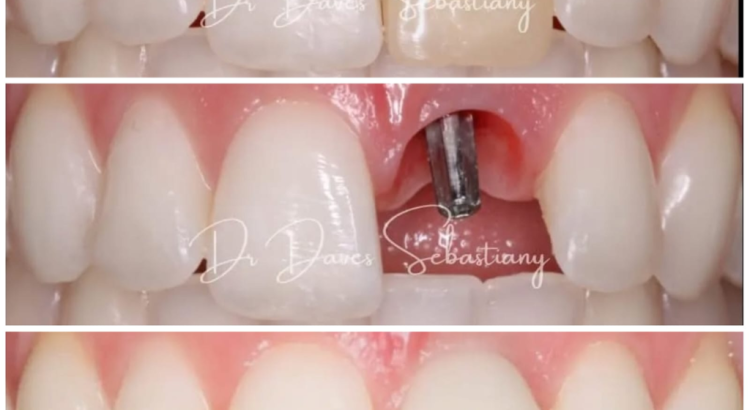 dentista realizando avaliação odontológica completa com tecnologia digital na Prime Sorriso