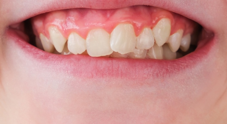 criança em consulta odontológica preventiva na Prime Sorriso