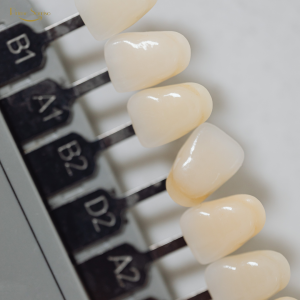 dentista avaliando dente escurecido em paciente na Prime Sorriso