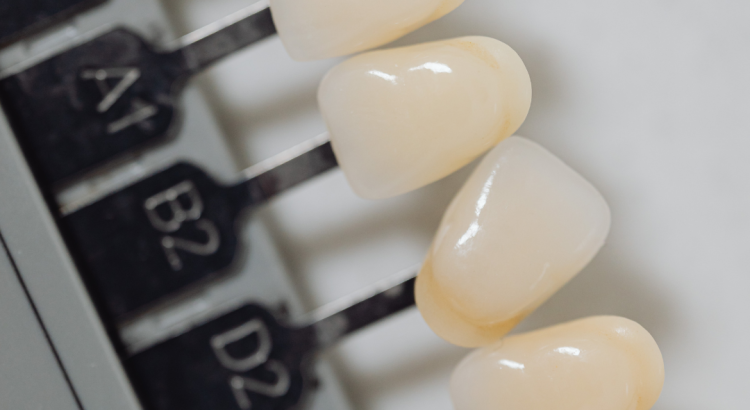 dentista avaliando dente escurecido em paciente na Prime Sorriso