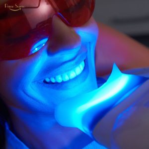 Sorriso branco após clareamento dental com orientação profissional