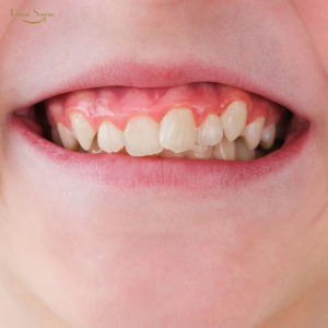 criança em consulta odontológica preventiva na Prime Sorriso